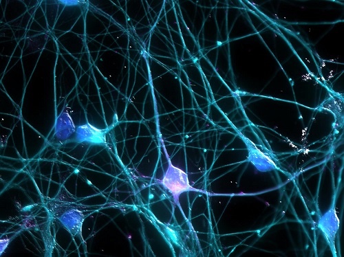 neuroni2.jpg